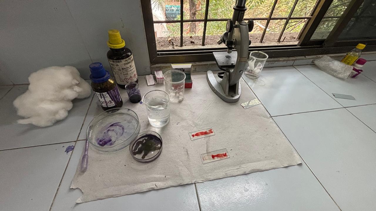 Blood Smear prepared by students for performing the DLC Practical