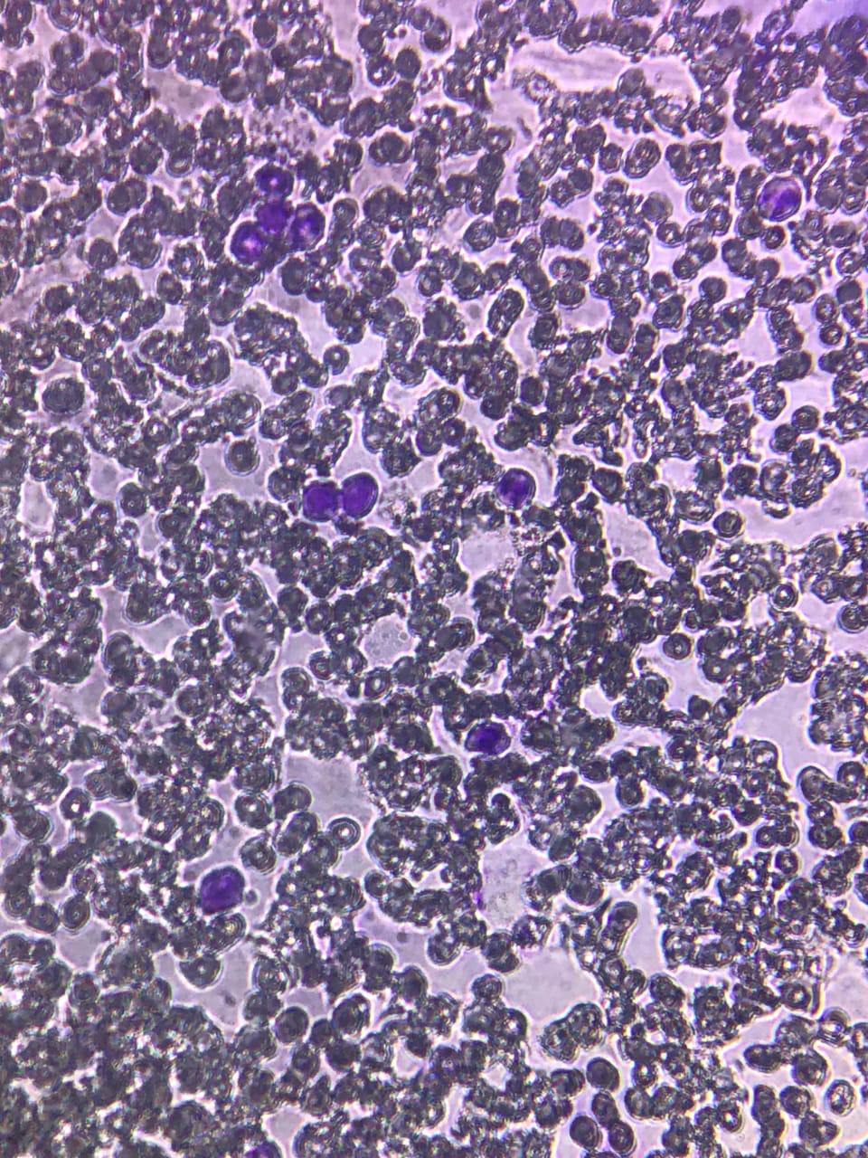 DLC slide under microscope showing different types of Leucocytes
