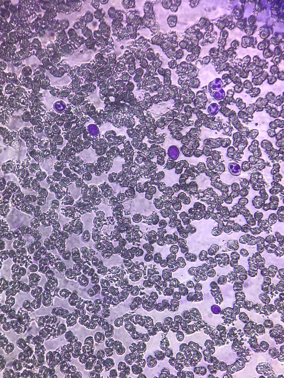 Different types of Leucocyte seen in the side under Microscope